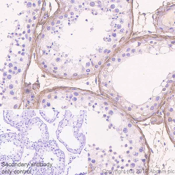 Immunohistochemistry (Formalin/PFA-fixed paraffin-embedded sections) - Anti-EFEMP1/Fibulin-3 antibody [EPR22855-4] (AB256457)
