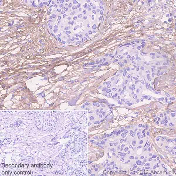 Immunohistochemistry (Formalin/PFA-fixed paraffin-embedded sections) - Anti-EFEMP1/Fibulin-3 antibody [EPR22855-4] (AB256457)