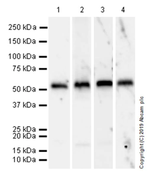 Western blot - Anti-EFEMP1/Fibulin-3 antibody [EPR22855-4] (AB256457)