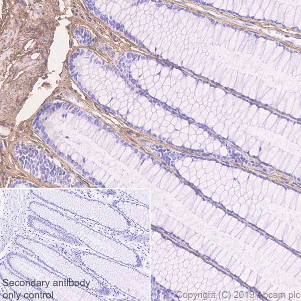 Immunohistochemistry (Formalin/PFA-fixed paraffin-embedded sections) - Anti-EFEMP1/Fibulin-3 antibody [EPR22855-4] - BSA and Azide free (AB259998)