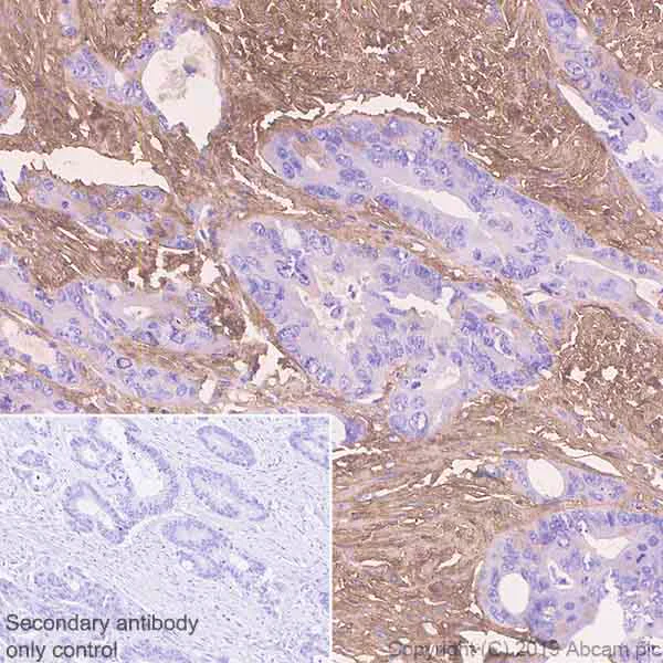 Immunohistochemistry (Formalin/PFA-fixed paraffin-embedded sections) - Anti-EFEMP1/Fibulin-3 antibody [EPR22855-4] - BSA and Azide free (AB259998)