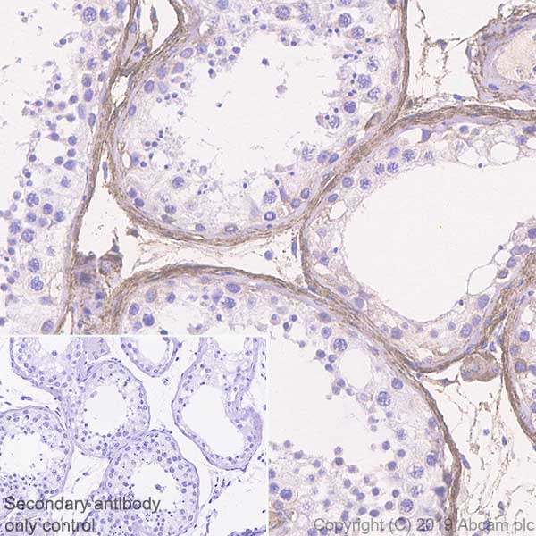 Immunohistochemistry (Formalin/PFA-fixed paraffin-embedded sections) - Anti-EFEMP1/Fibulin-3 antibody [EPR22855-4] - BSA and Azide free (AB259998)