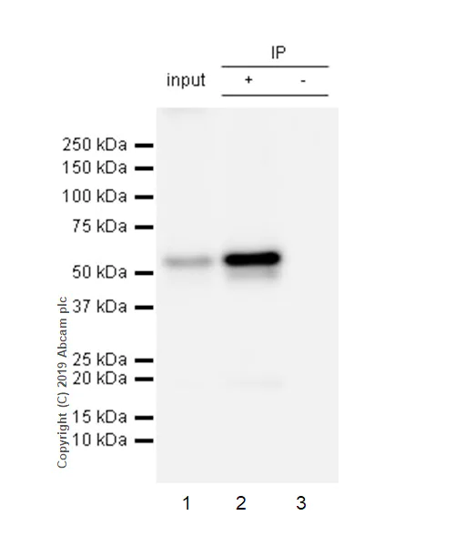 Immunoprecipitation - Anti-EFEMP1/Fibulin-3 antibody [EPR22855-4] - BSA and Azide free (AB259998)