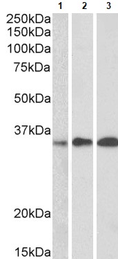 Western blot - Anti-EFHD2/SWS1 antibody (AB24368)