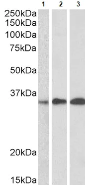 Western blot - Anti-EFHD2/SWS1 antibody (AB24368)