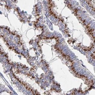 Immunohistochemistry (Formalin/PFA-fixed paraffin-embedded sections) - Anti-EFL1 antibody (AB188305), expandable thumbnail