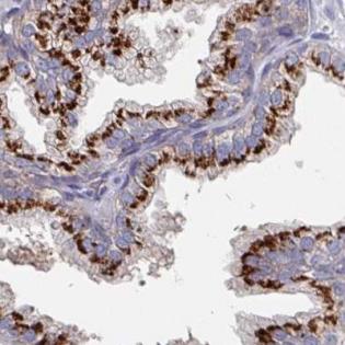 Immunohistochemistry (Formalin/PFA-fixed paraffin-embedded sections) - Anti-EFL1 antibody (AB188305), expandable thumbnail