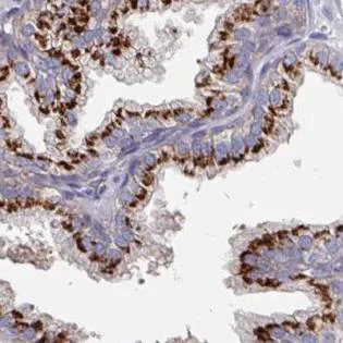 Immunohistochemistry (Formalin/PFA-fixed paraffin-embedded sections) - Anti-EFL1 antibody (AB188305)