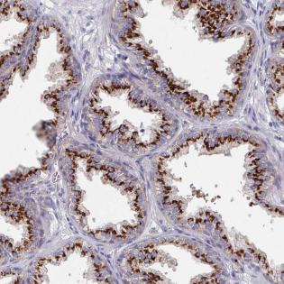Immunohistochemistry (Formalin/PFA-fixed paraffin-embedded sections) - Anti-EFL1 antibody (AB188305), expandable thumbnail