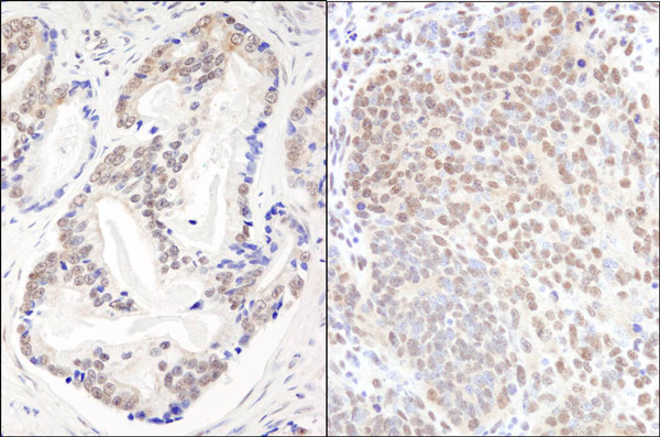 Immunohistochemistry (Formalin/PFA-fixed paraffin-embedded sections) - Anti-EFTUD2 antibody (AB72456), expandable thumbnail