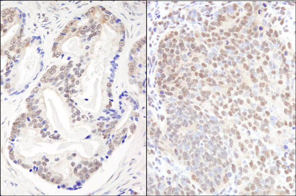 Immunohistochemistry (Formalin/PFA-fixed paraffin-embedded sections) - Anti-EFTUD2 antibody (AB72456)