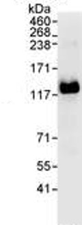 Immunoprecipitation - Anti-EFTUD2 antibody (AB72456), expandable thumbnail