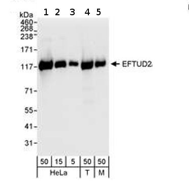 Western blot - Anti-EFTUD2 antibody (AB72456), expandable thumbnail