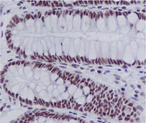 Immunohistochemistry (Formalin/PFA-fixed paraffin-embedded sections) - Anti-EFTUD2 antibody [EPR16055(B)] (AB188327), expandable thumbnail