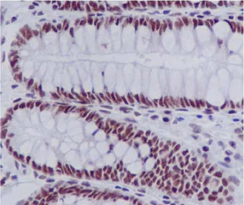 Immunohistochemistry (Formalin/PFA-fixed paraffin-embedded sections) - Anti-EFTUD2 antibody [EPR16055(B)] (AB188327)