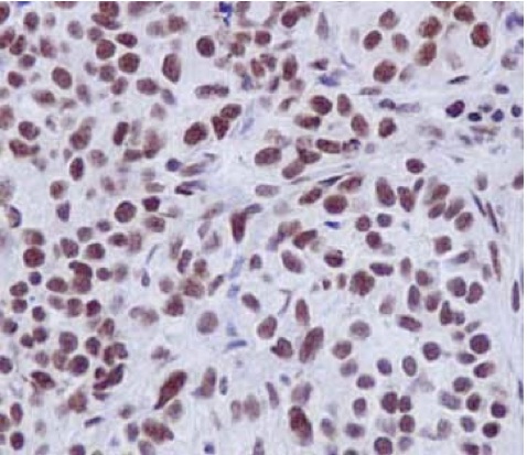 Immunohistochemistry (Formalin/PFA-fixed paraffin-embedded sections) - Anti-EFTUD2 antibody [EPR16055(B)] (AB188327), expandable thumbnail