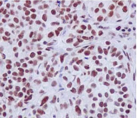 Immunohistochemistry (Formalin/PFA-fixed paraffin-embedded sections) - Anti-EFTUD2 antibody [EPR16055(B)] - BSA and Azide free (AB250955)