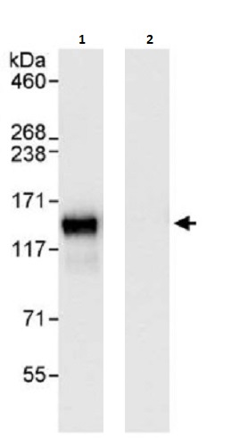 Immunoprecipitation - Anti-Eg5 antibody (AB264176)