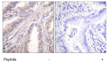 Immunohistochemistry (Formalin/PFA-fixed paraffin-embedded sections) - Anti-Eg5 antibody (AB61199)