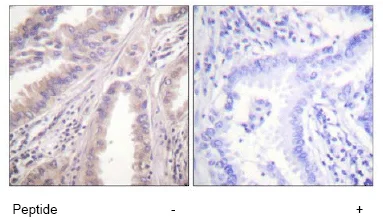 Immunohistochemistry (Formalin/PFA-fixed paraffin-embedded sections) - Anti-Eg5 antibody (AB61199)