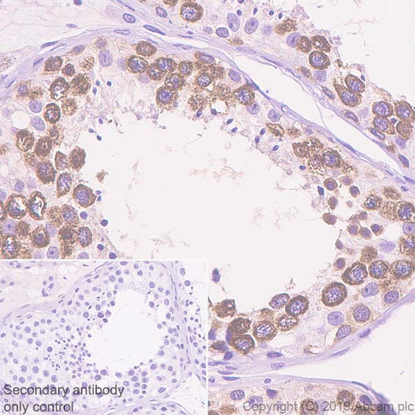 Immunohistochemistry (Formalin/PFA-fixed paraffin-embedded sections) - Anti-Eg5 antibody [EPR23276-52] (AB254298), expandable thumbnail