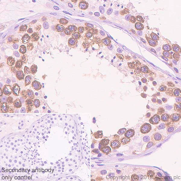 Immunohistochemistry (Formalin/PFA-fixed paraffin-embedded sections) - Anti-Eg5 antibody [EPR23276-52] (AB254298)