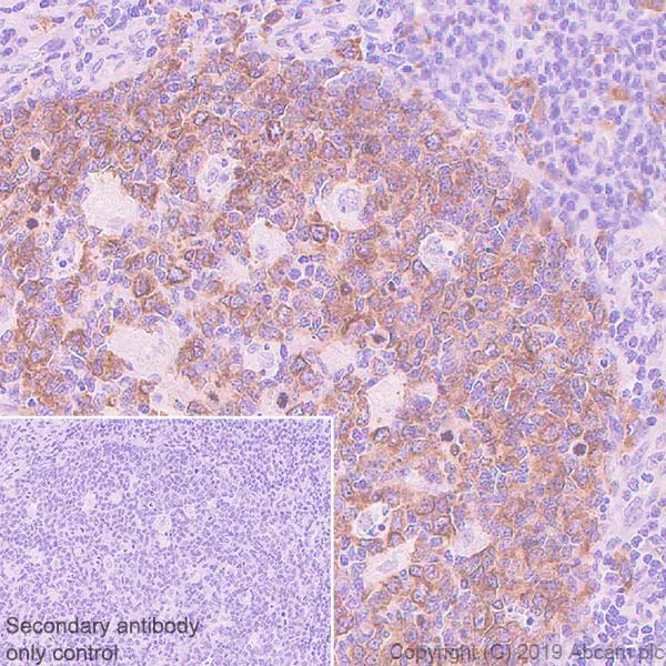Immunohistochemistry (Formalin/PFA-fixed paraffin-embedded sections) - Anti-Eg5 antibody [EPR23276-52] - BSA and Azide free (AB270754)