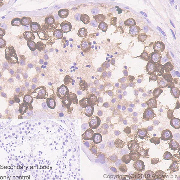 Immunohistochemistry (Formalin/PFA-fixed paraffin-embedded sections) - Anti-Eg5 antibody [EPR23277-60] (AB254299)