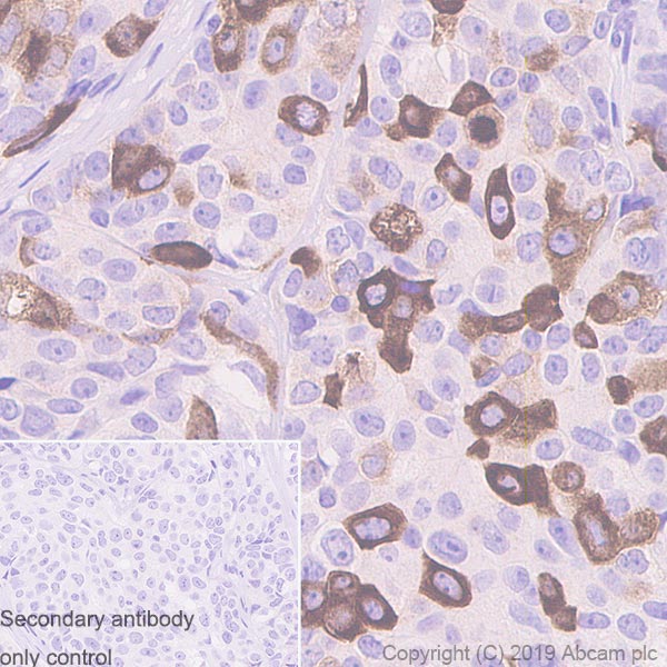 Immunohistochemistry (Formalin/PFA-fixed paraffin-embedded sections) - Anti-Eg5 antibody [EPR23277-60] (ab254299), expandable thumbnail