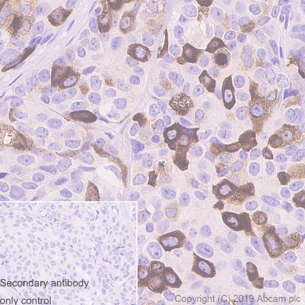 Immunohistochemistry (Formalin/PFA-fixed paraffin-embedded sections) - Anti-Eg5 antibody [EPR23277-60] (AB254299)