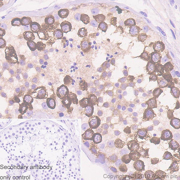 Immunohistochemistry (Formalin/PFA-fixed paraffin-embedded sections) - Anti-Eg5 antibody [EPR23277-60] - BSA and Azide free (AB270409)