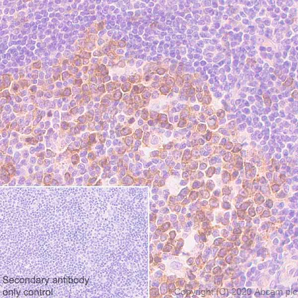 Immunohistochemistry (Formalin/PFA-fixed paraffin-embedded sections) - Anti-Eg5 antibody [EPR23277-7] (AB272220)