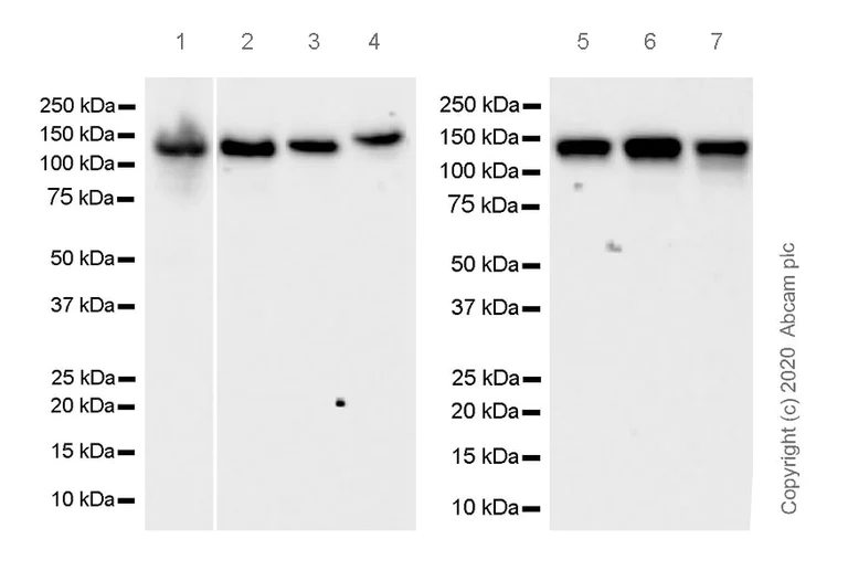Western blot - Anti-Eg5 antibody [EPR23277-7] (AB272220)