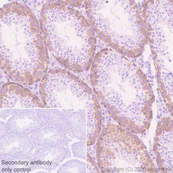 Immunohistochemistry (Formalin/PFA-fixed paraffin-embedded sections) - Anti-Eg5 antibody [EPR23277-7] - BSA and Azide free (AB272226), expandable thumbnail