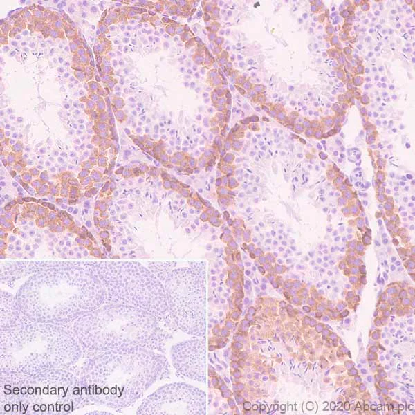 Immunohistochemistry (Formalin/PFA-fixed paraffin-embedded sections) - Anti-Eg5 antibody [EPR23277-7] - BSA and Azide free (AB272226)