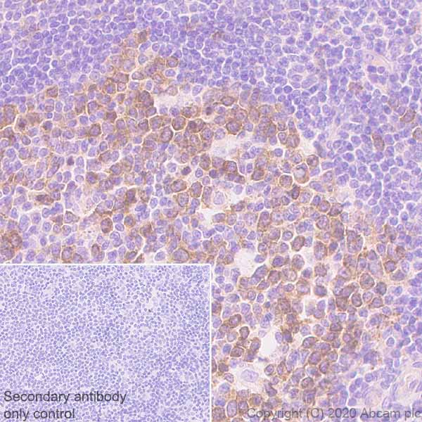 Immunohistochemistry (Formalin/PFA-fixed paraffin-embedded sections) - Anti-Eg5 antibody [EPR23277-7] - BSA and Azide free (AB272226), expandable thumbnail