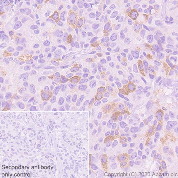 Immunohistochemistry (Formalin/PFA-fixed paraffin-embedded sections) - Anti-Eg5 antibody [EPR23277-7] - BSA and Azide free (ab272226), expandable thumbnail
