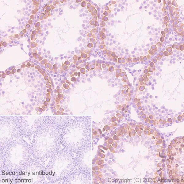 Immunohistochemistry (Formalin/PFA-fixed paraffin-embedded sections) - Anti-Eg5 antibody [EPR23277-7] - BSA and Azide free (AB272226)