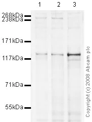 Western blot - Anti-Eg5 antibody [mAbcam 51976] (AB51976)