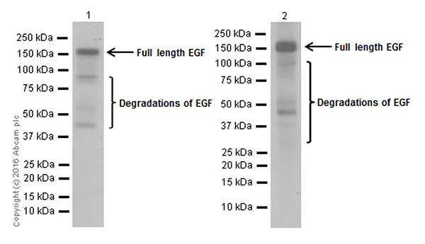 Western blot - Anti-EGF antibody [EPR19173] (AB184265)