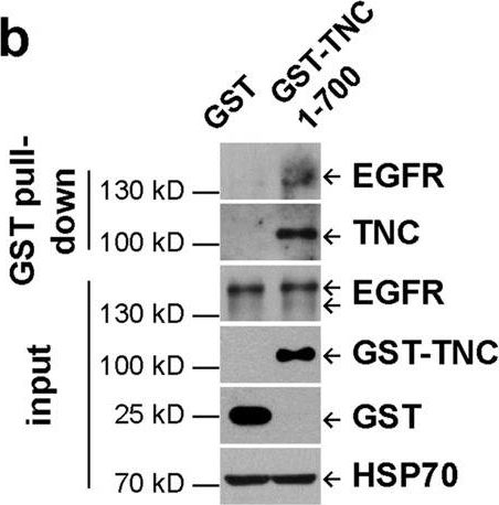 Western blot - Anti-EGF antibody [EPR19899] (AB206423)