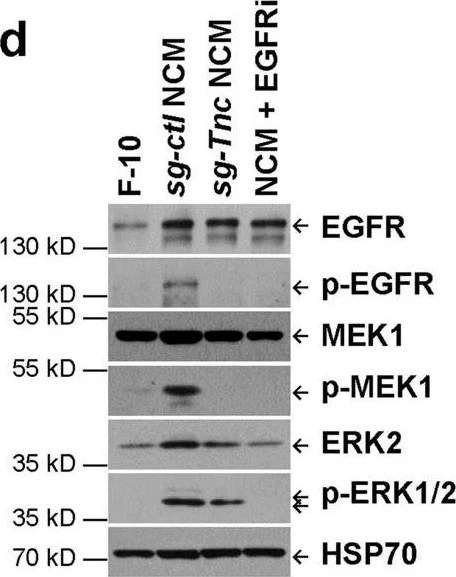 Western blot - Anti-EGF antibody [EPR19899] (AB206423)