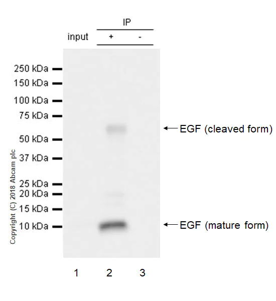 Immunoprecipitation - Anti-EGF antibody [EPR21926] (AB218831)