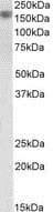 Western blot - Anti-EGF antibody - N-terminal (AB219348)