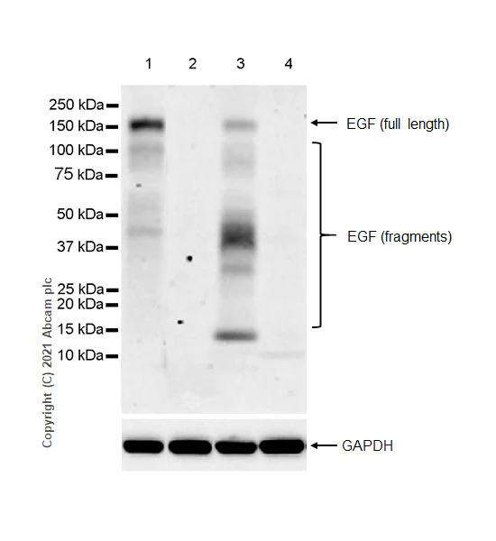 Western blot - Anti-EGF antibody [RM1015] - BSA and Azide free (AB288300)