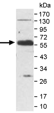Western blot - Anti-EGFL6 antibody (AB140079), expandable thumbnail