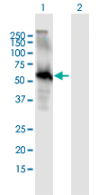 Western blot - Anti-EGFL6 antibody (AB167281)