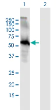 Western blot - Anti-EGFL6 antibody (AB167281)