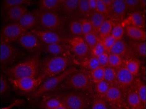 Immunocytochemistry/ Immunofluorescence - Anti-EGFR antibody (AB131498)