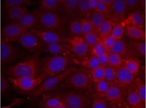 Immunocytochemistry/ Immunofluorescence - Anti-EGFR antibody (AB131498)